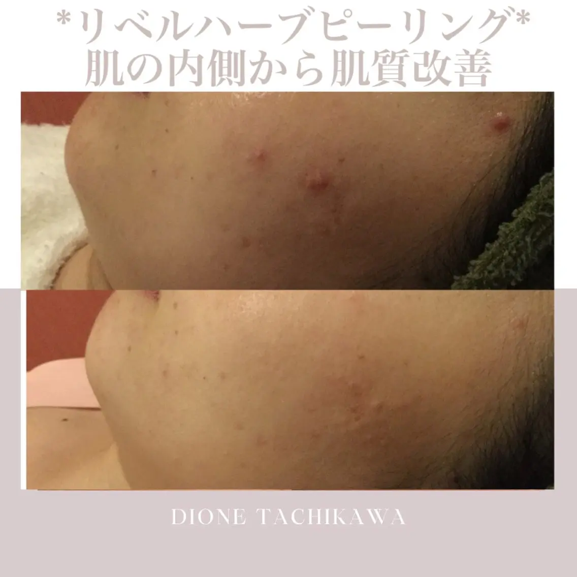 エステ Dione 立川店のエステ・リラクイメージ