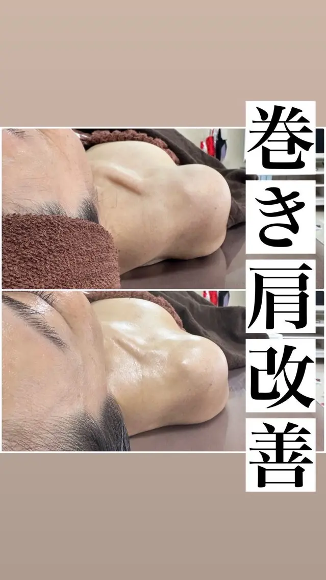 艶肌メニュー🤎【巻き肩改善フェイシャルエステ💆‍♀️】猫背撃退🔥の写真
