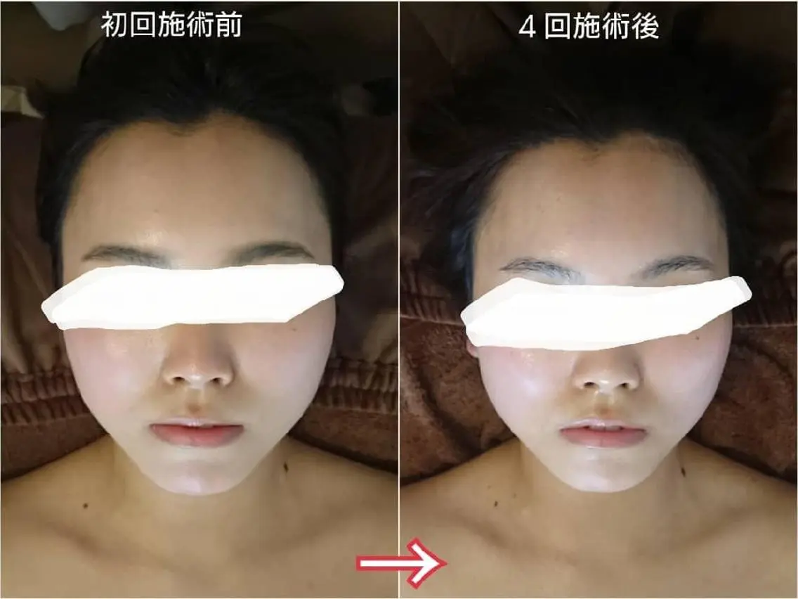 小顔美容整体& 美爪育成Jelissのエステ・リラクイメージ