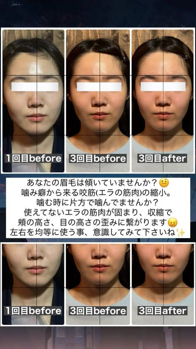 エステ リラク 💎後悔させない小顔 矯正💎イトヤマ🌱のエステ・リラクイメージ