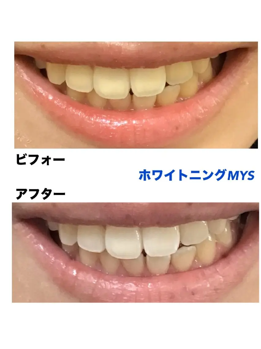 ホワイトニングサロン MYS自由が丘店のエステ・リラクイメージ