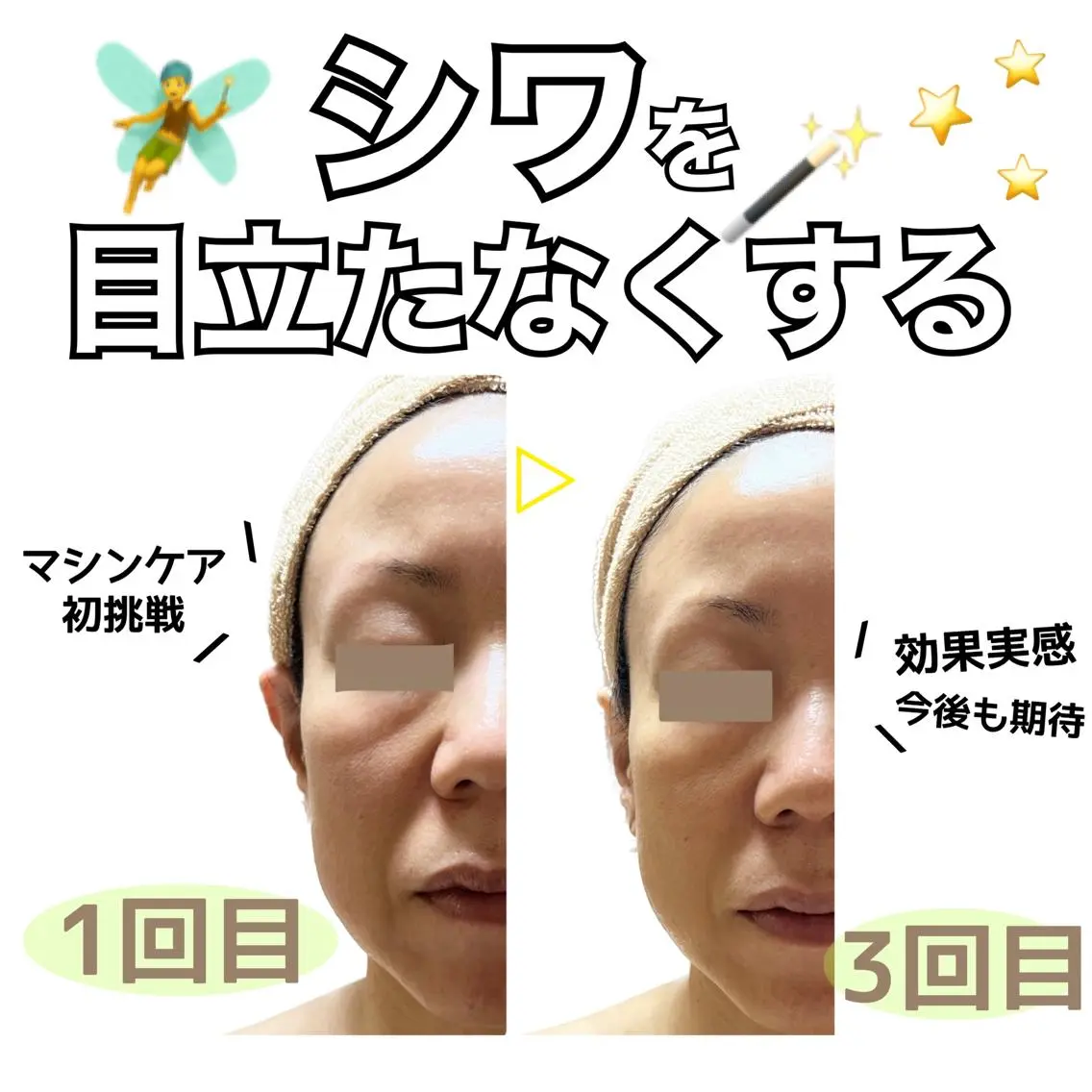 stella都度払い 痩身小顔まつげパーマのマツエク・マツパデザイン