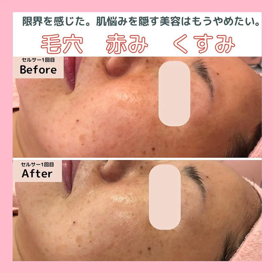 三沢市エステサロン Sブランペタルのエステ・リラクイメージ