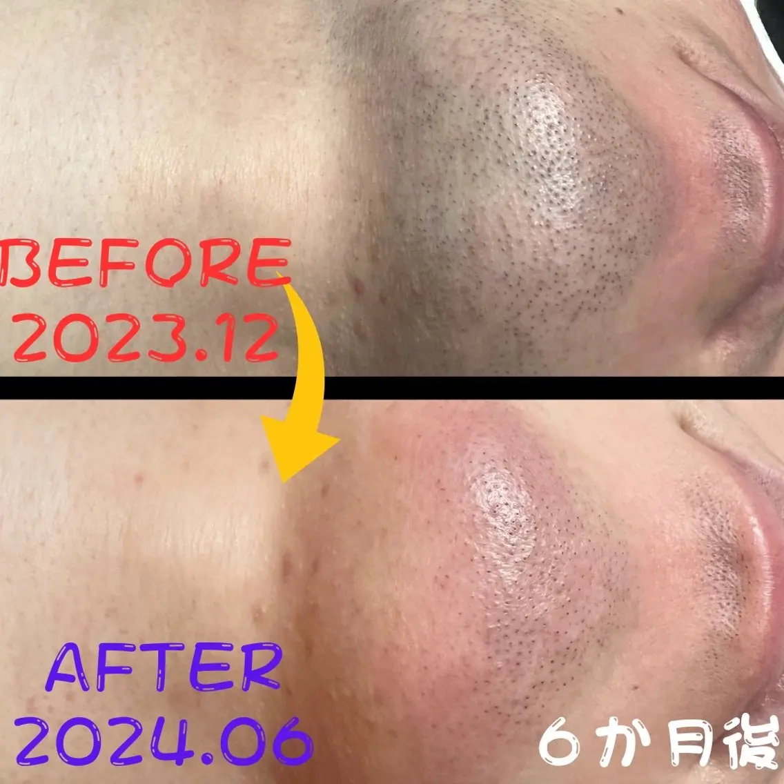 メンズ キッズ 脱毛 メンズ脱毛フェリッセ /男女🆗キッズ🆗のエステ・リラクイメージ