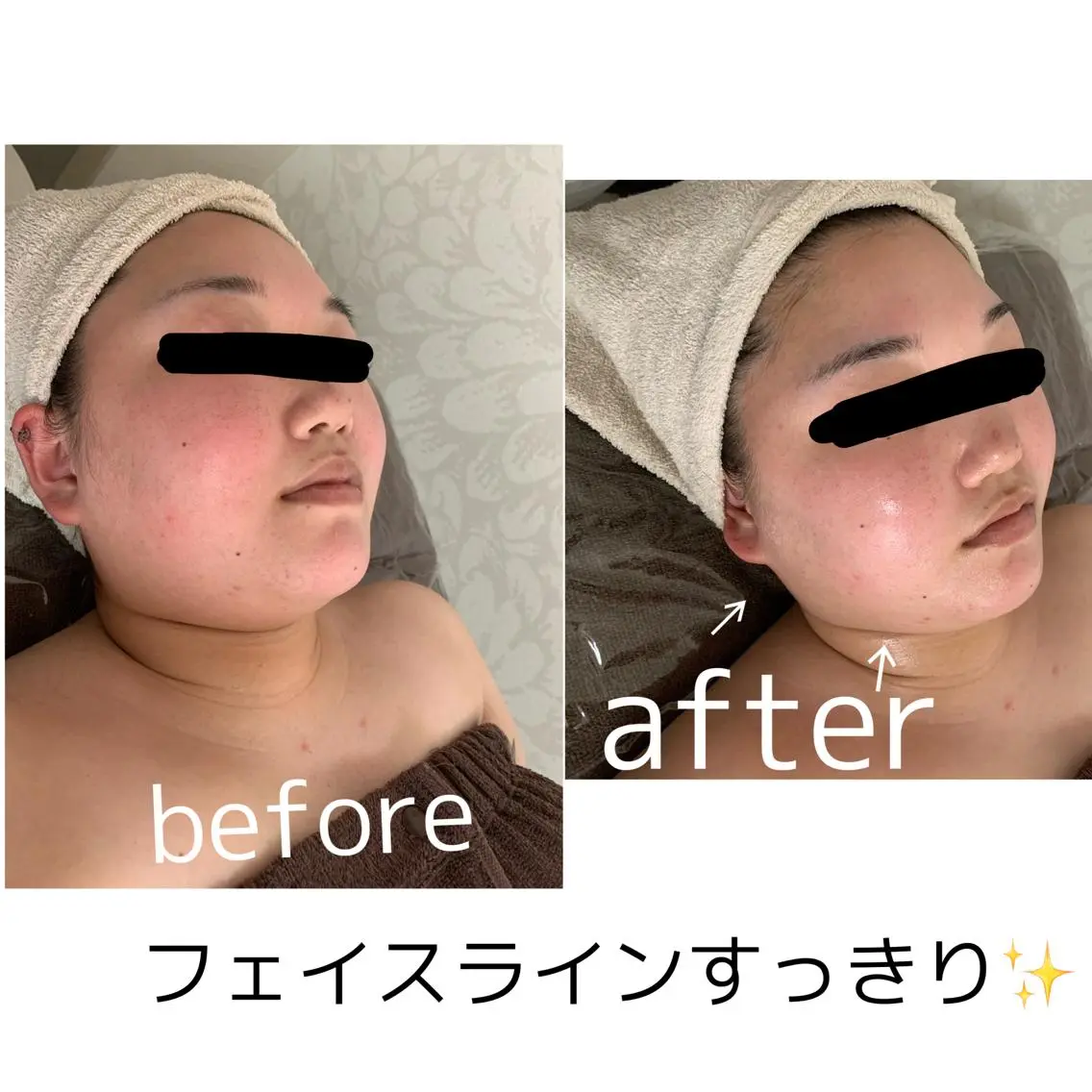 ビューティーサロン Lemoのエステ・リラクイメージ