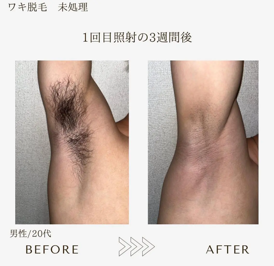 脱毛 本八幡salon83 ♡エイトミーのエステ・リラクイメージ