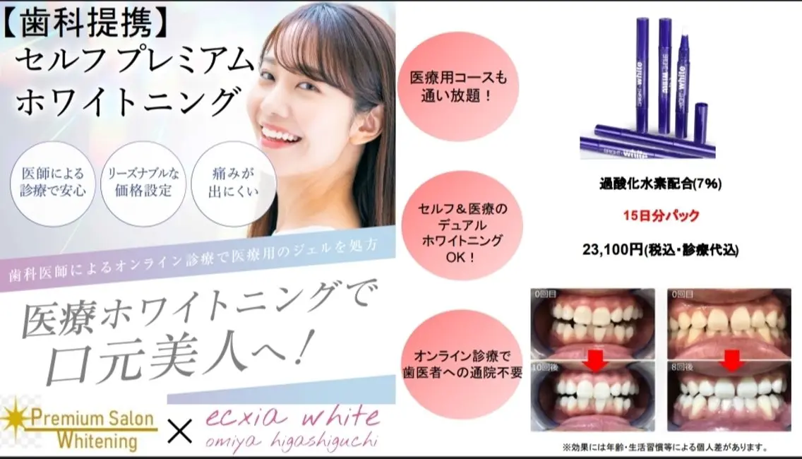 その他 セルフホワイトニング エクシア大宮東口店のその他イメージ