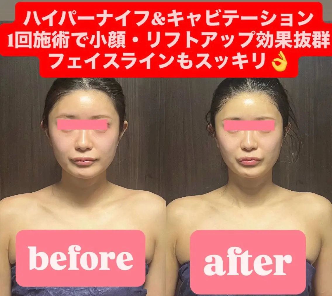メンズ ハイパーナイフ専門 熊田陽子のエステ・リラクイメージ