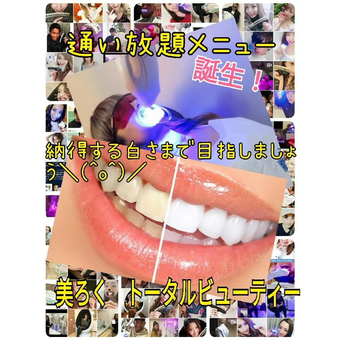 【通い放題年間継続プラン✨】♔納得する白さまで目指しましょう✨セルフホワイトニングし放題🦷　11000円/1ヶ月の写真