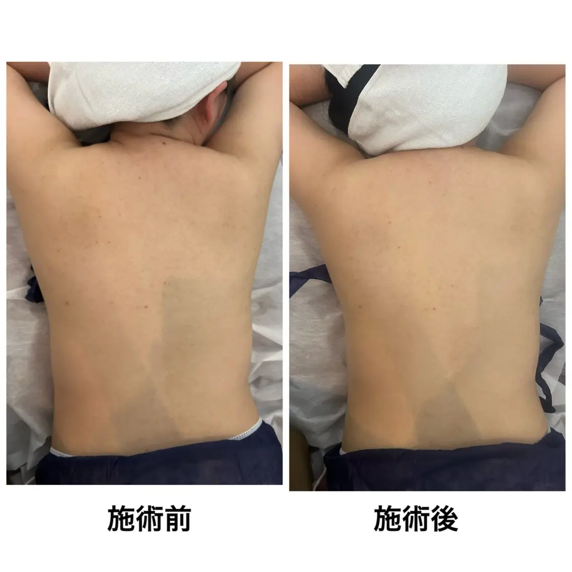 【癒されたい方必見‼️】全身の血行を良くし老廃物をお身体の外へ✨オールハンド全身ボディートリートメントの写真
