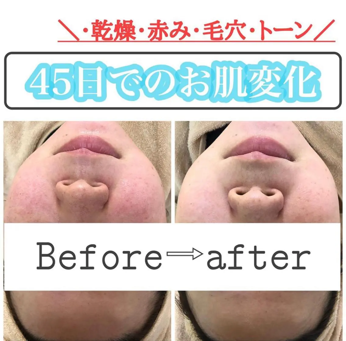 ショート カラー パーマ ヘアアレンジ メンズ キッズ ネイル マツエク・マツパ エステ ニキビ&跡改善サロン オーナー光木のエステ・リラクイメージ