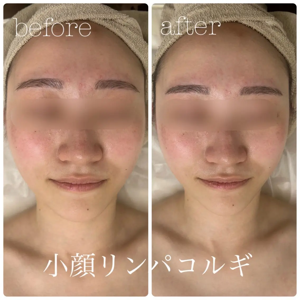 フェイシャルサロン CHIARA 荒田のエステ・リラクイメージ