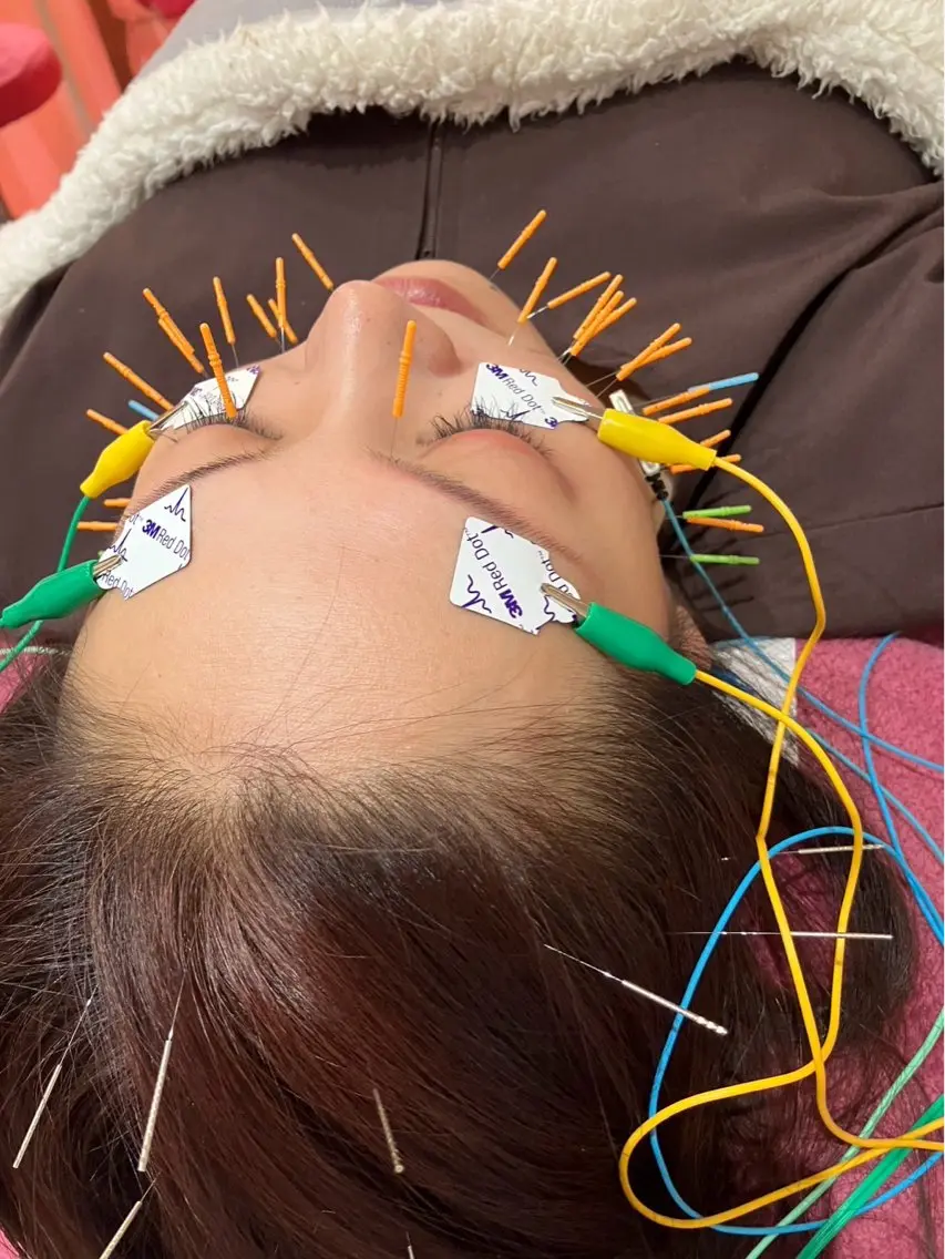 その他 美容鍼灸女性専用 りんご鍼灸治療院のその他イメージ