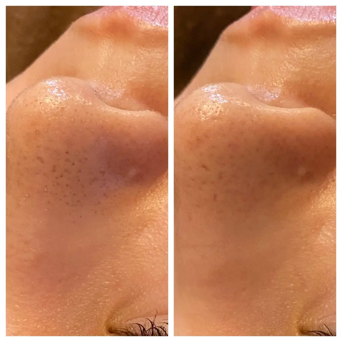 エステ 肌質改善専門 ハーブ /毛穴洗浄 リエイトのエステ・リラクイメージ