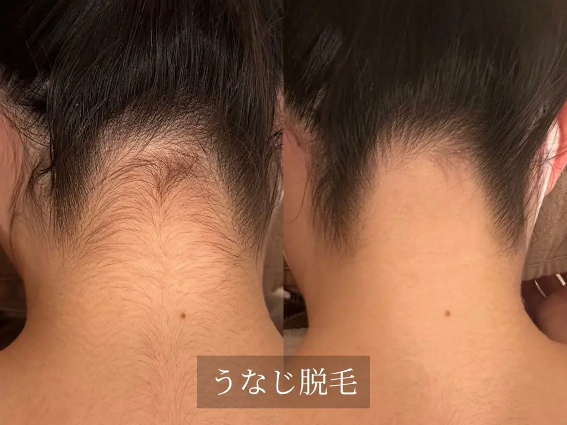 脱毛サロン Arumのエステ・リラクイメージ