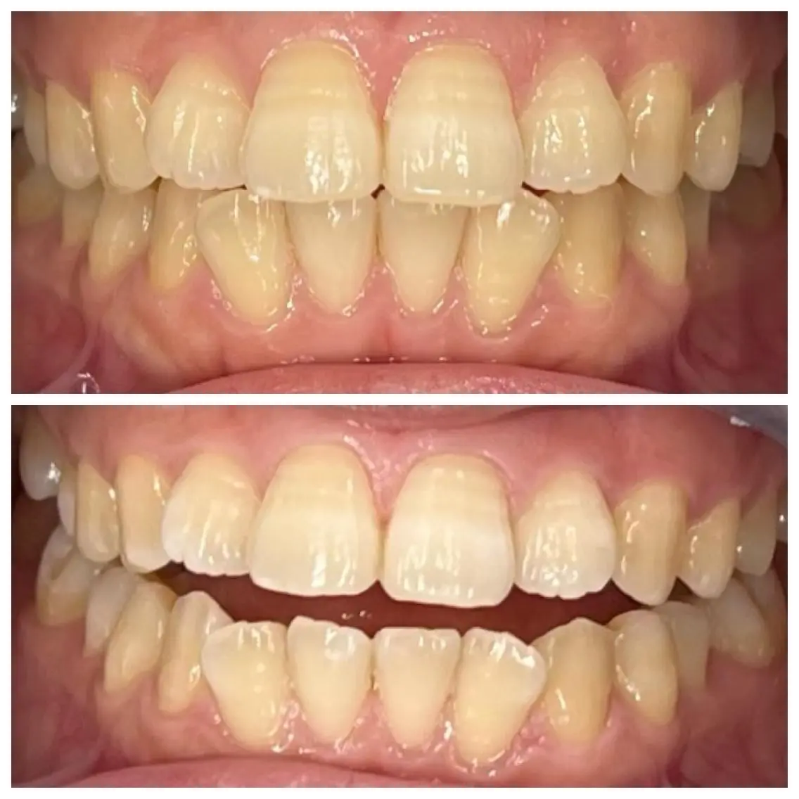 ホワイトニング🦷 ネイル💅LEAのその他イメージ
