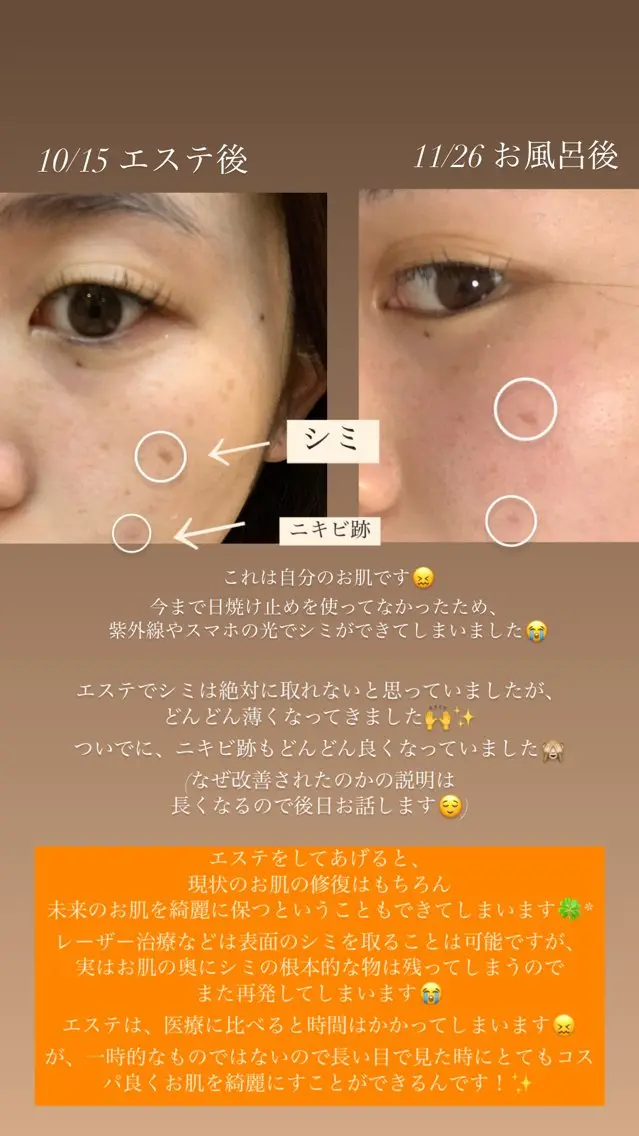 メンズ エステ リラク 肌質改善🫧 みゆのエステ・リラクイメージ