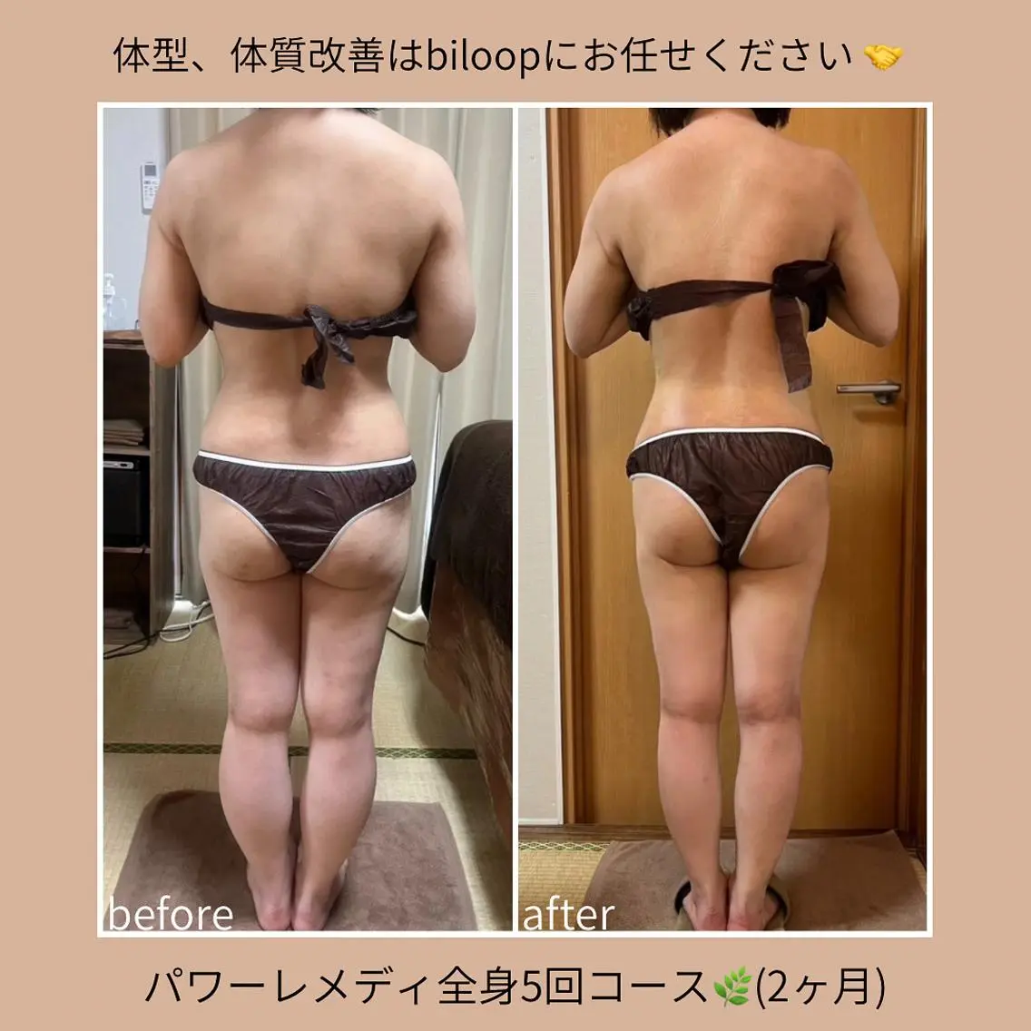 《本気痩せ×疲労改善 》 BILOOPのエステ・リラクイメージ