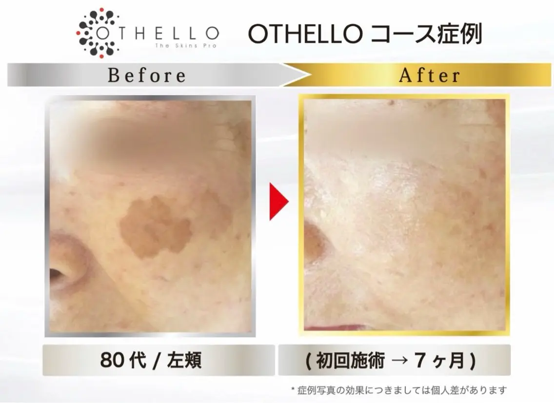 エステ VANISH たやがきの眉毛・アイブロウイメージ