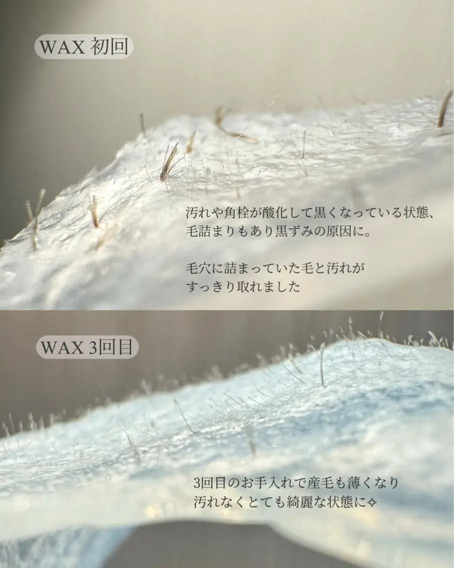 フェイスWAXトリートメントの写真