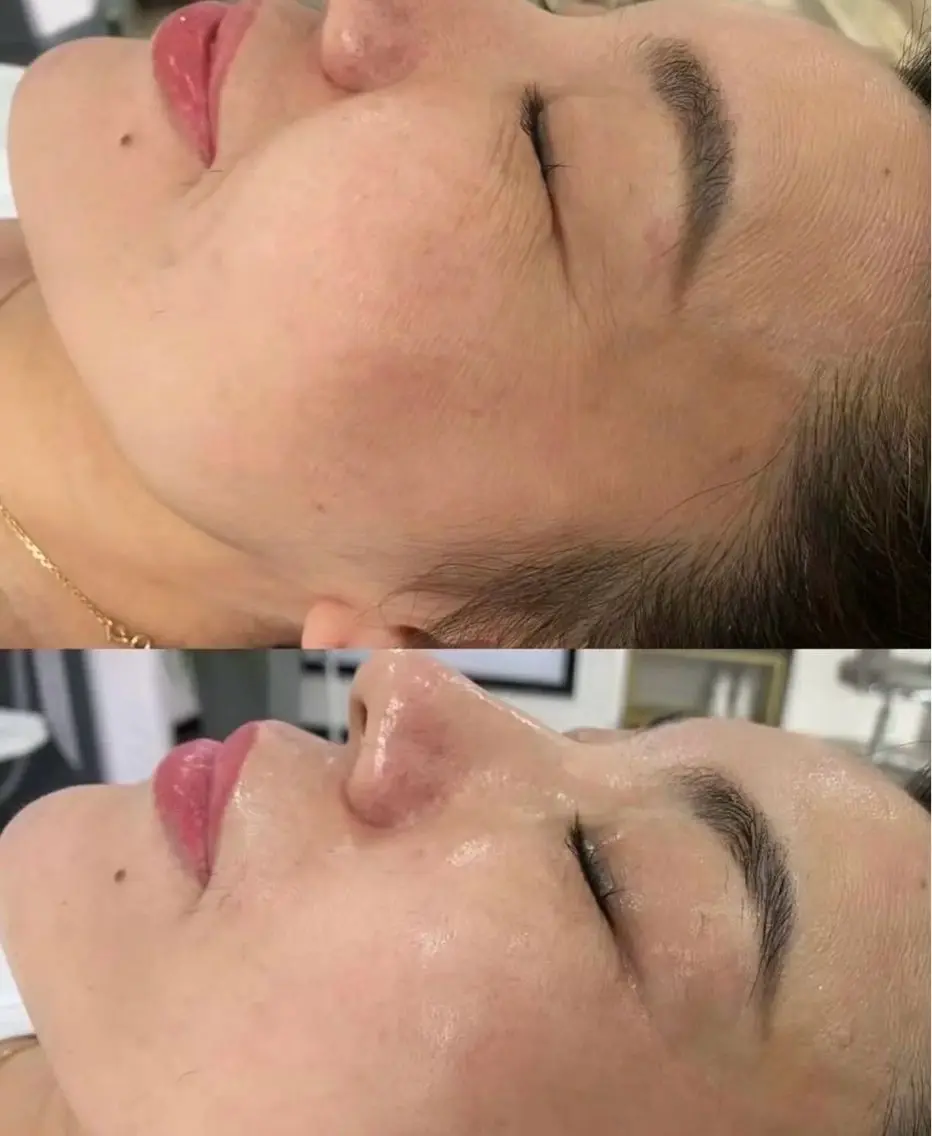 アイブロウ エステ 愛維美水光美肌専門店 メンズレディースokのエステ・リラクイメージ