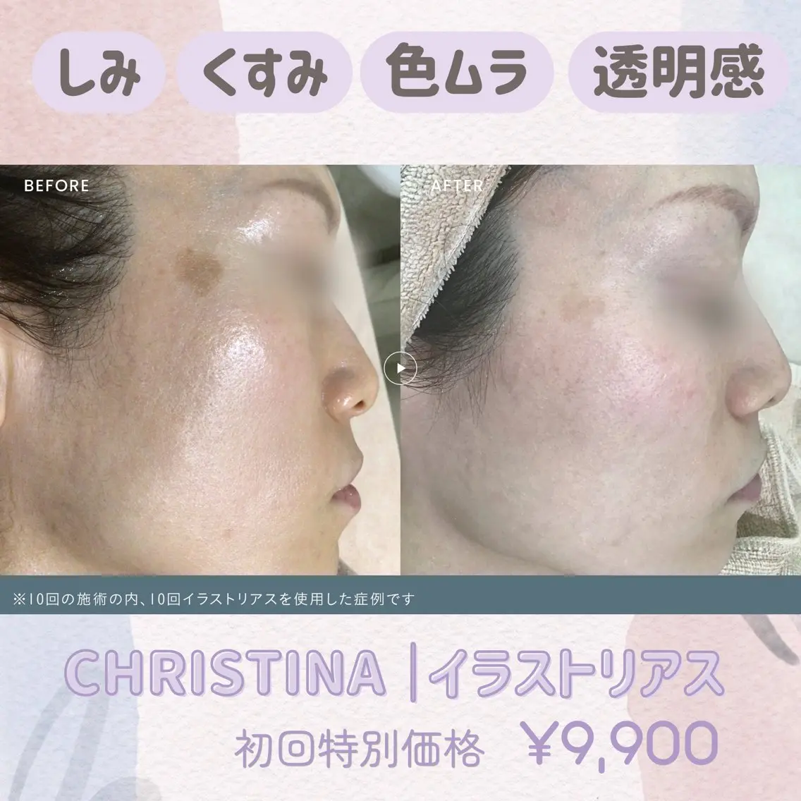 【初回】しみ・くすみ・色ムラに♡CHRISTINA イラストリアス ¥9,900の写真