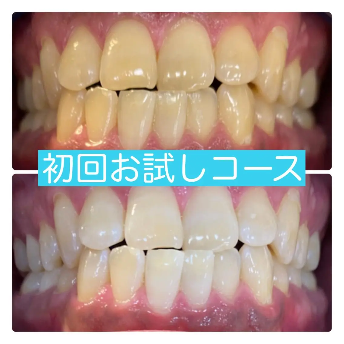 その他 ホワイトニングルーム 横浜店のその他イメージ