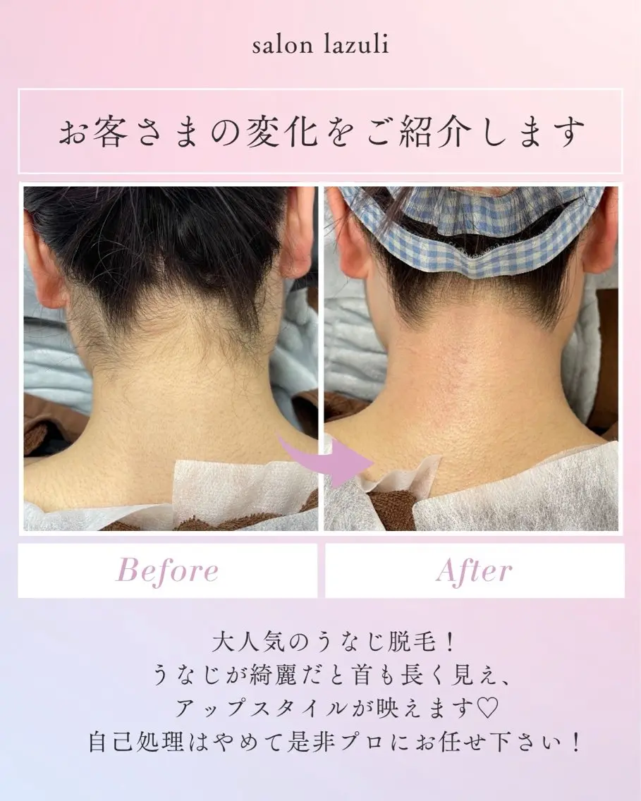 脱毛 野中 起子のエステ・リラクイメージ