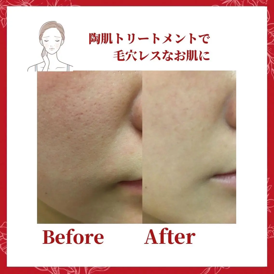 ミディアム カラー パーマ ヘアアレンジ メンズ キッズ ネイル マツエク・マツパ Amaryllis 🌹のエステ・リラクイメージ