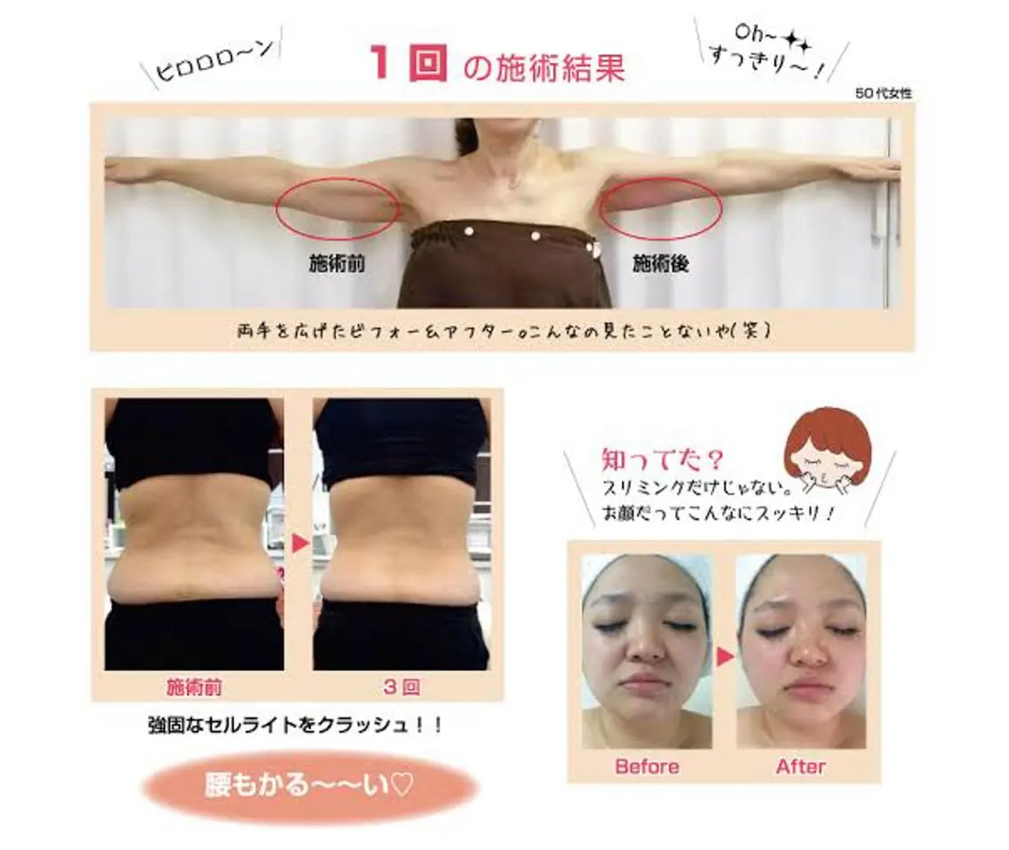 ミディアム パーマ ネイル マツエク・マツパ 小顔矯正・美容鍼 美鍼堂のエステ・リラクイメージ