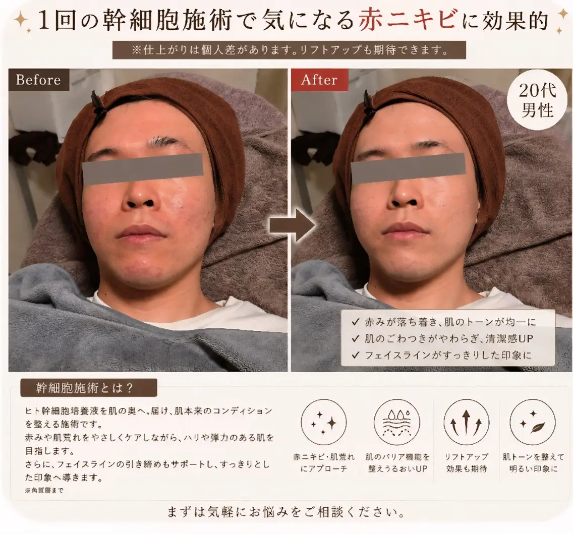 美肌salon Cureのエステ・リラクイメージ