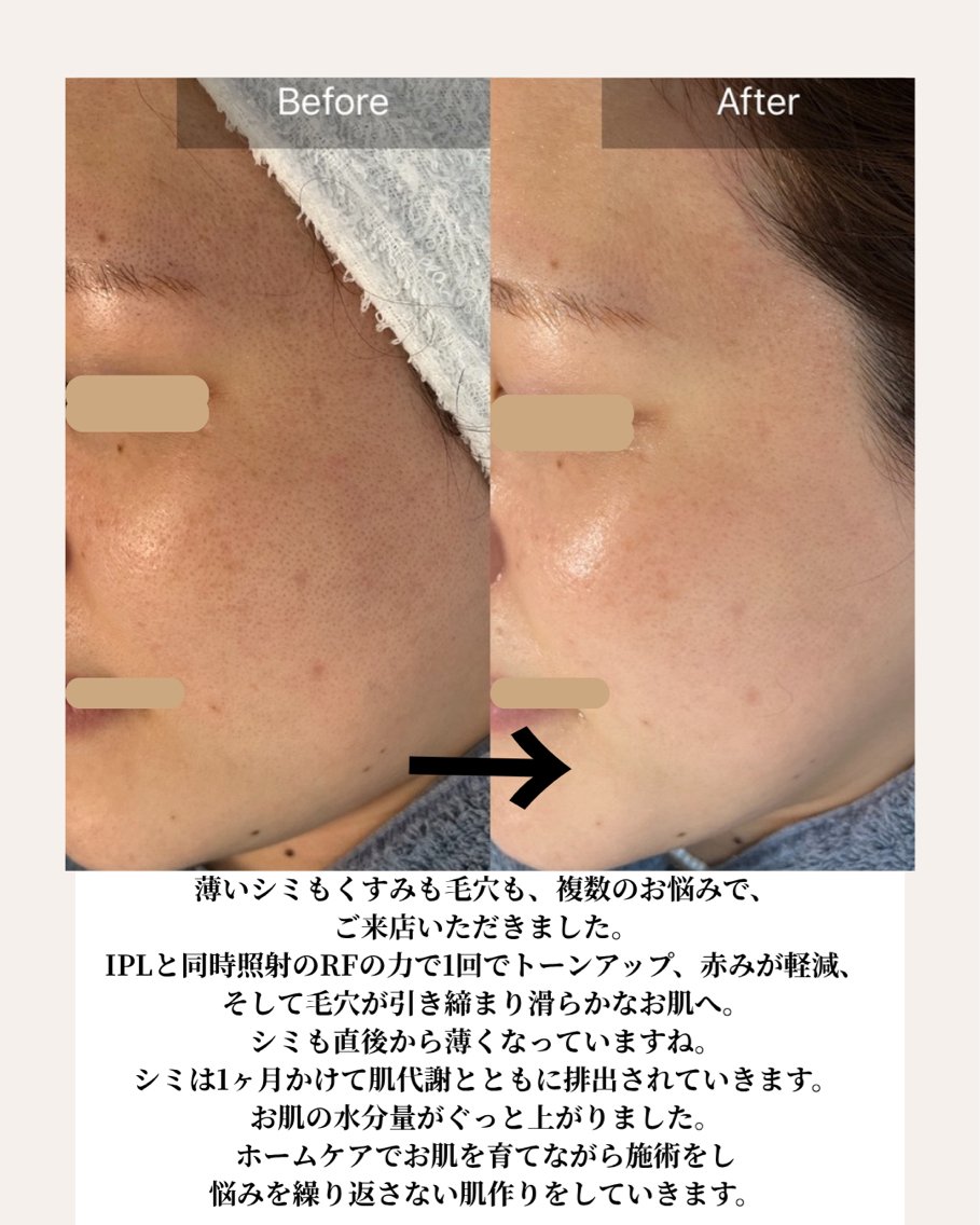 エステ 岡 えり子のエステ・リラクイメージ