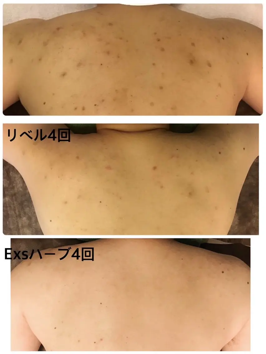 エステ MI SUZUのエステ・リラクイメージ