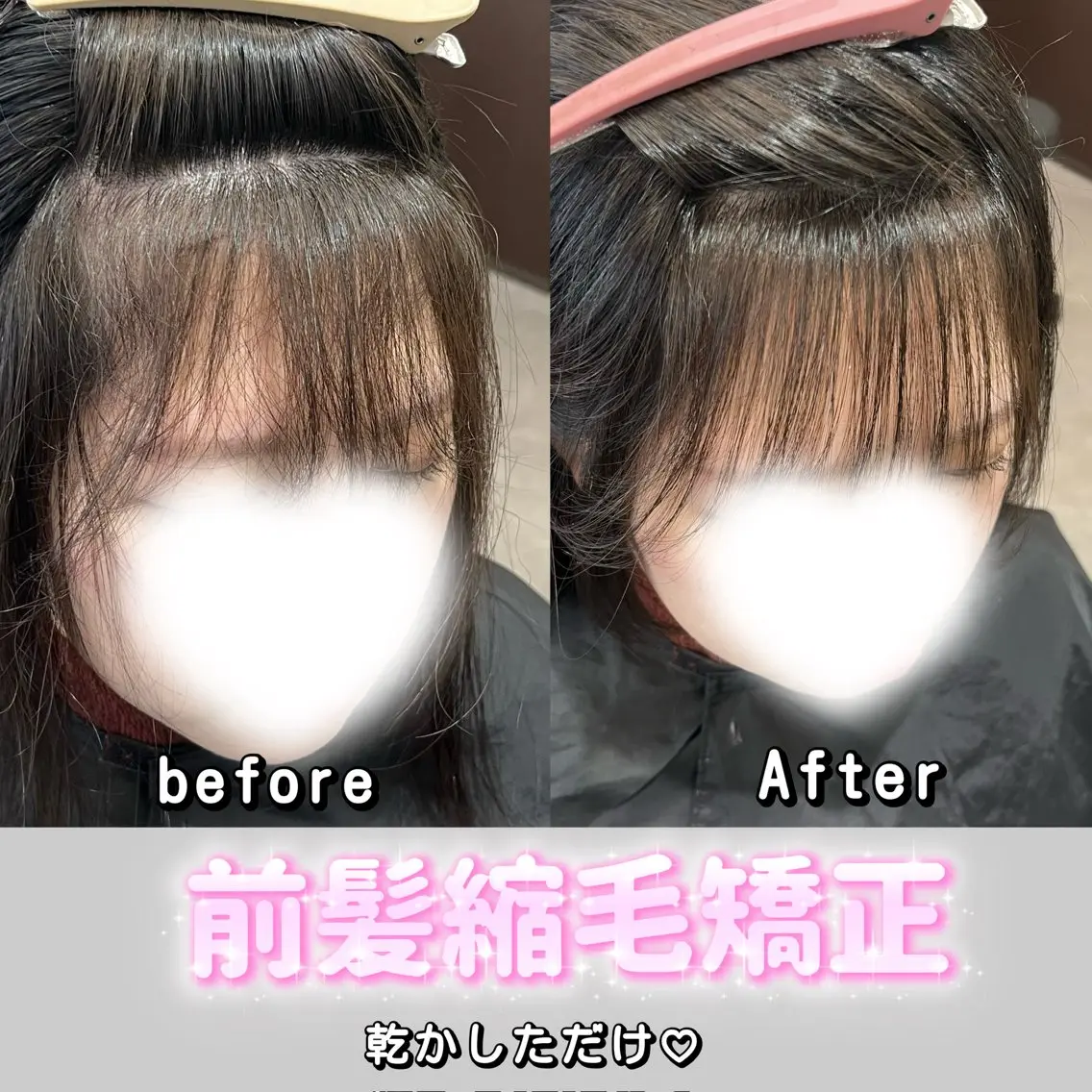前髪クロスパーマ（前髪縮毛矯正）の写真