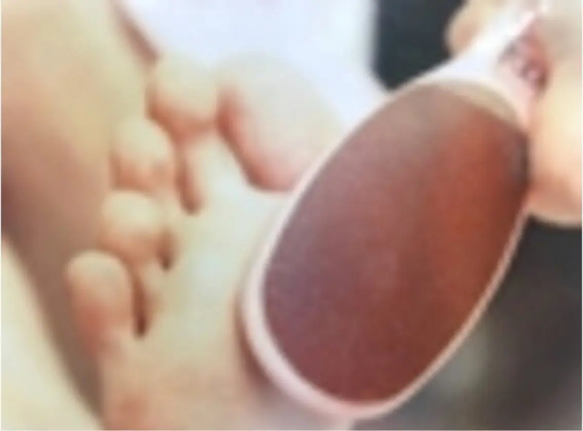 足裏ツルツル👣【Foot角質ケア¥3300】(たまプラーザ店)の写真