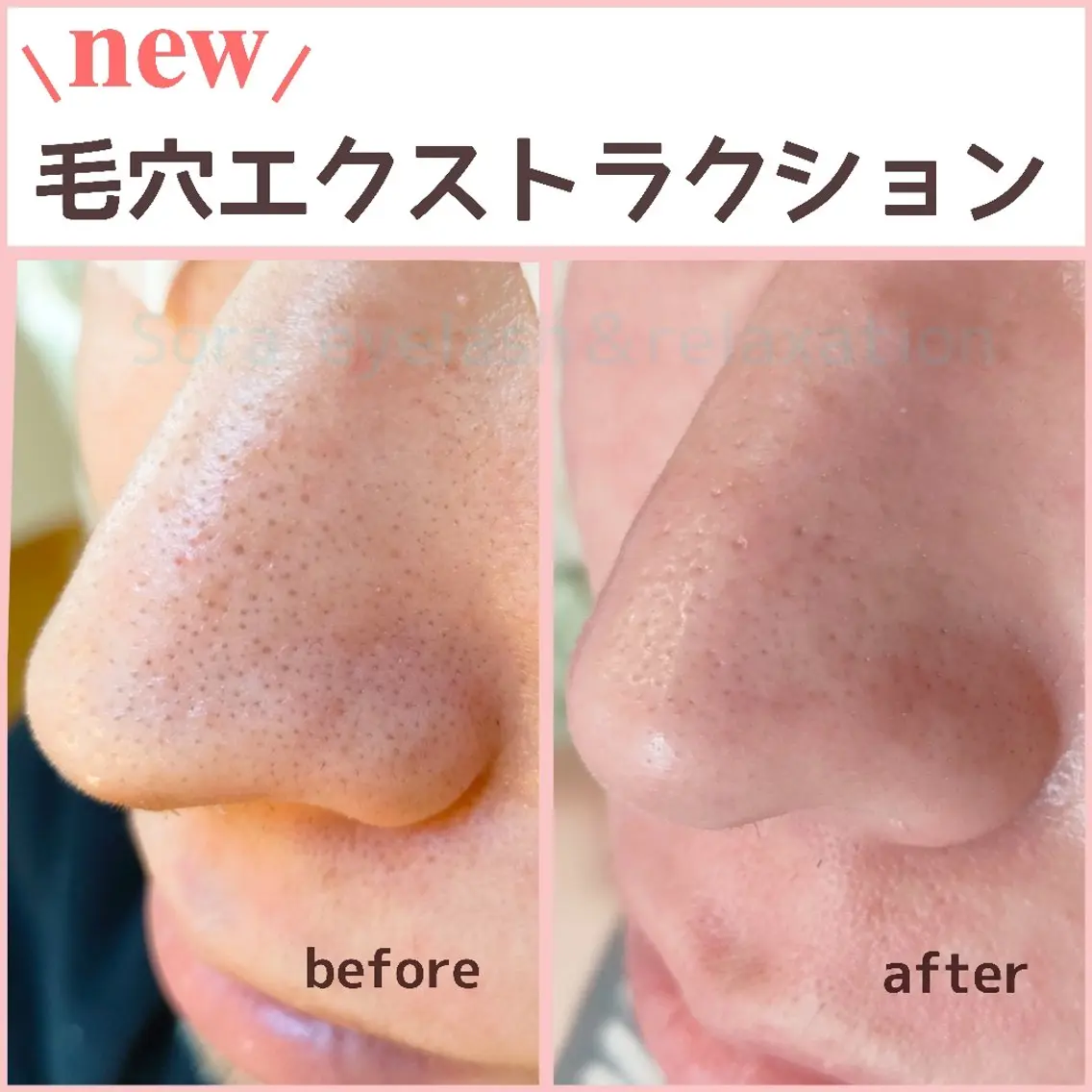 エステ Sora. なるみのマツエク・マツパデザイン