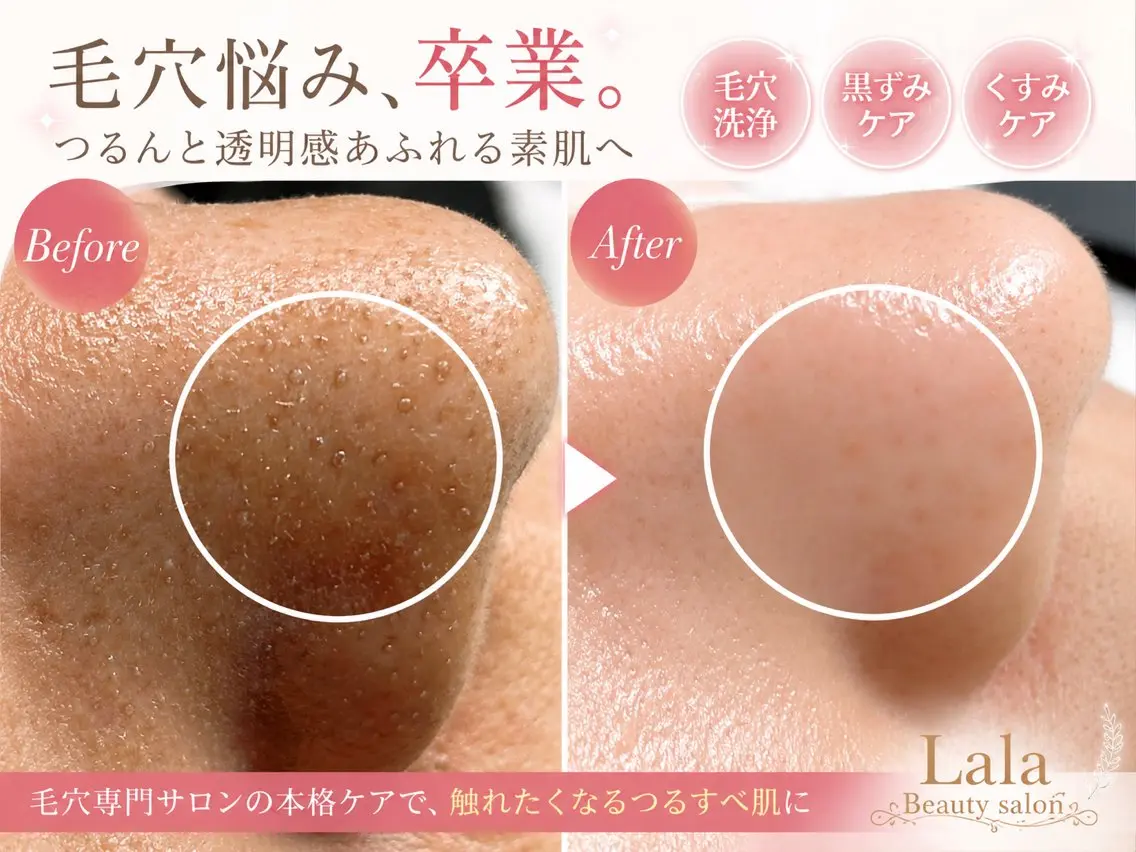 その他 Lala Beautyのその他イメージ
