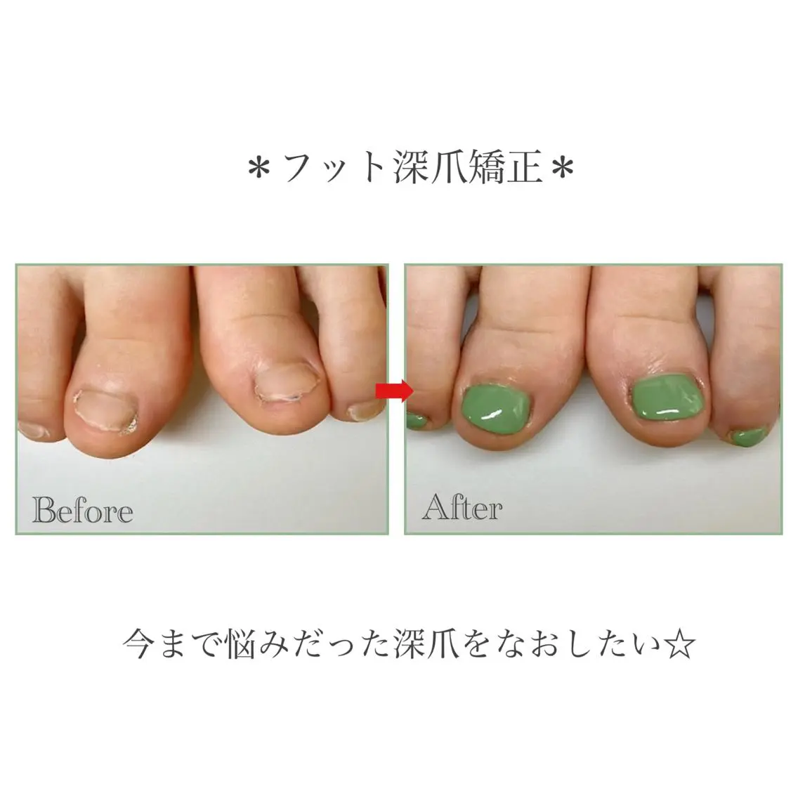ネイル フットネイル ネイルサロン アリュームのネイルデザイン