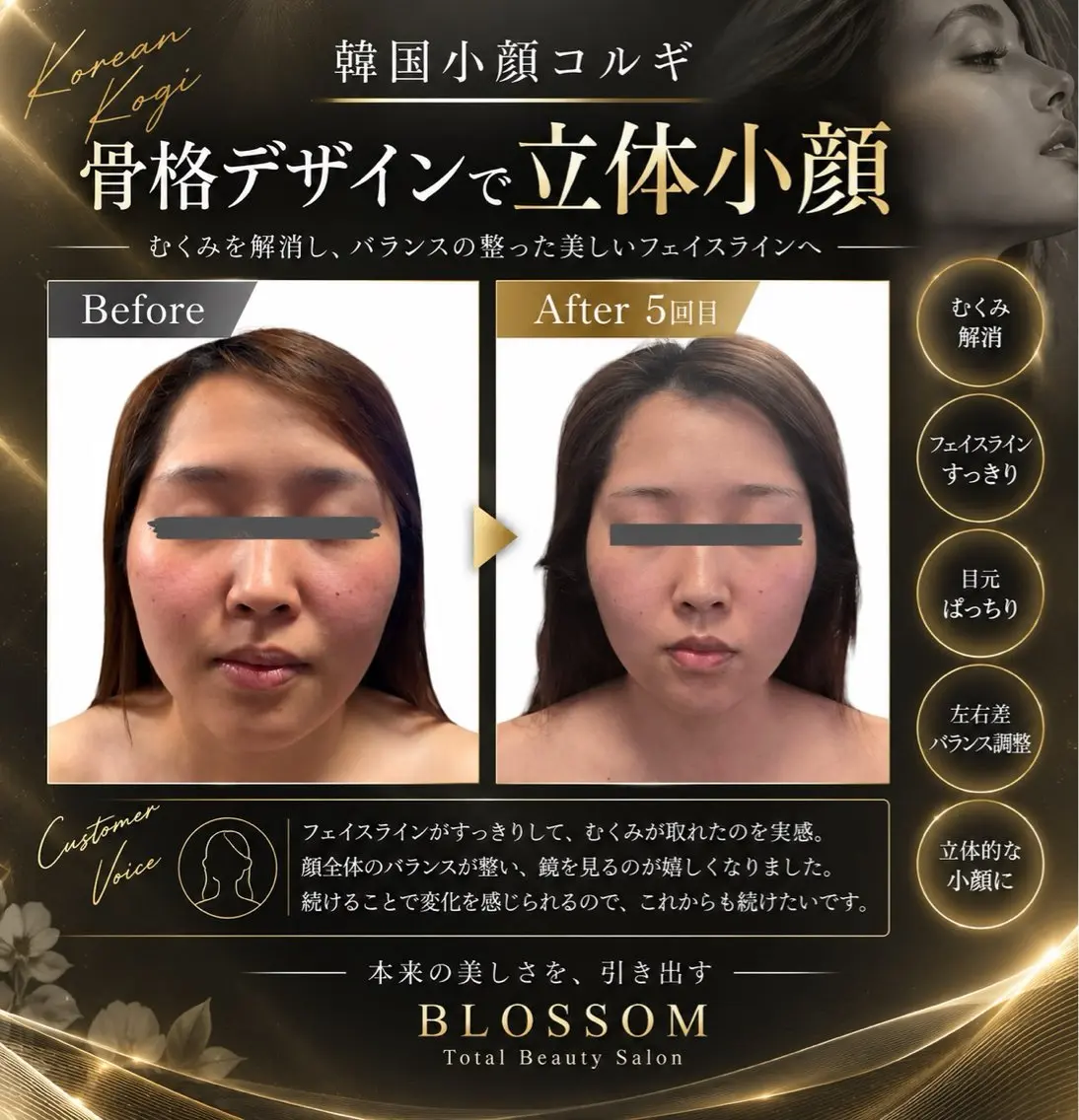 BLOSSOM 菊地のその他イメージ