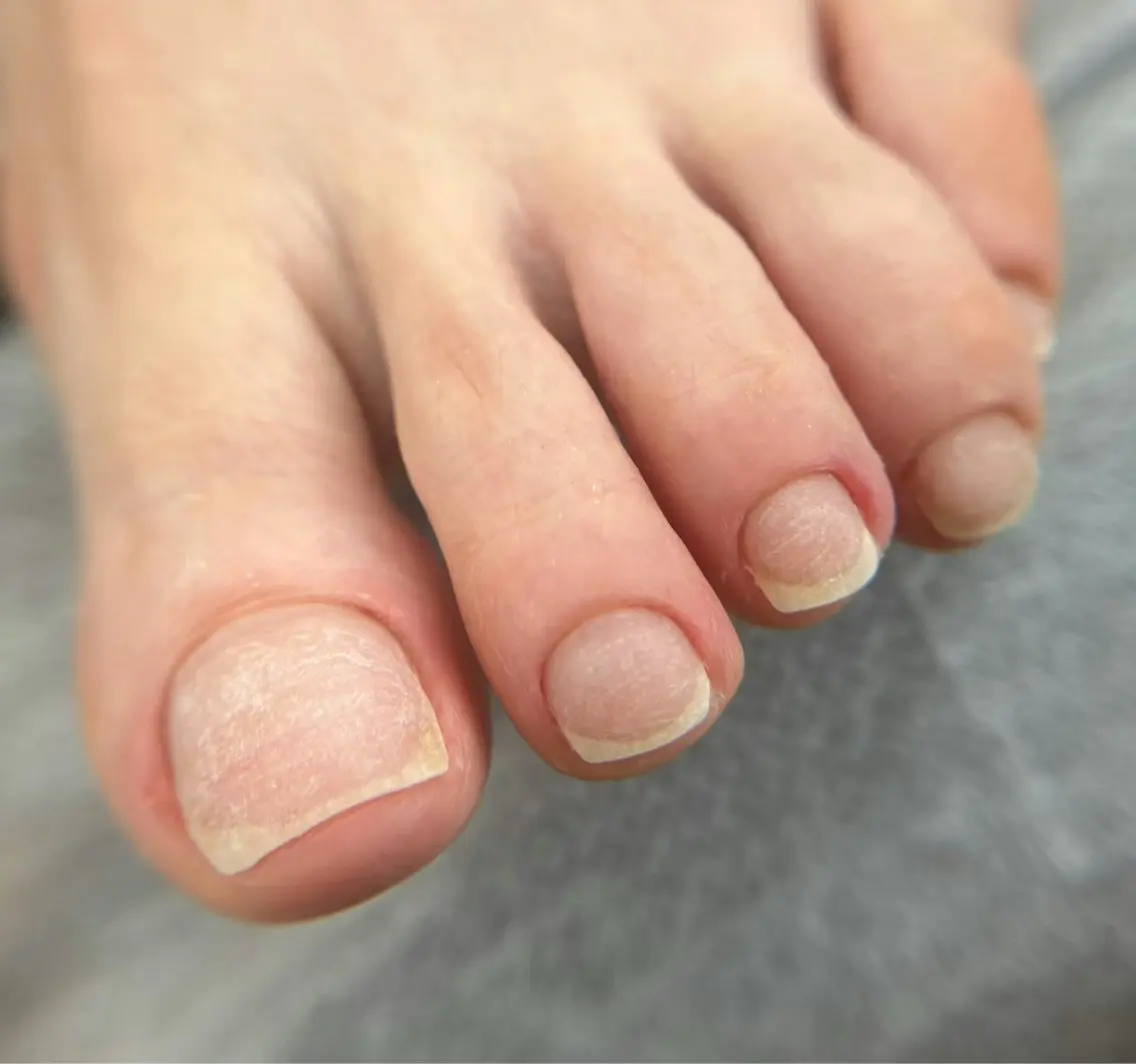 フットケア込み　オフのみの写真
