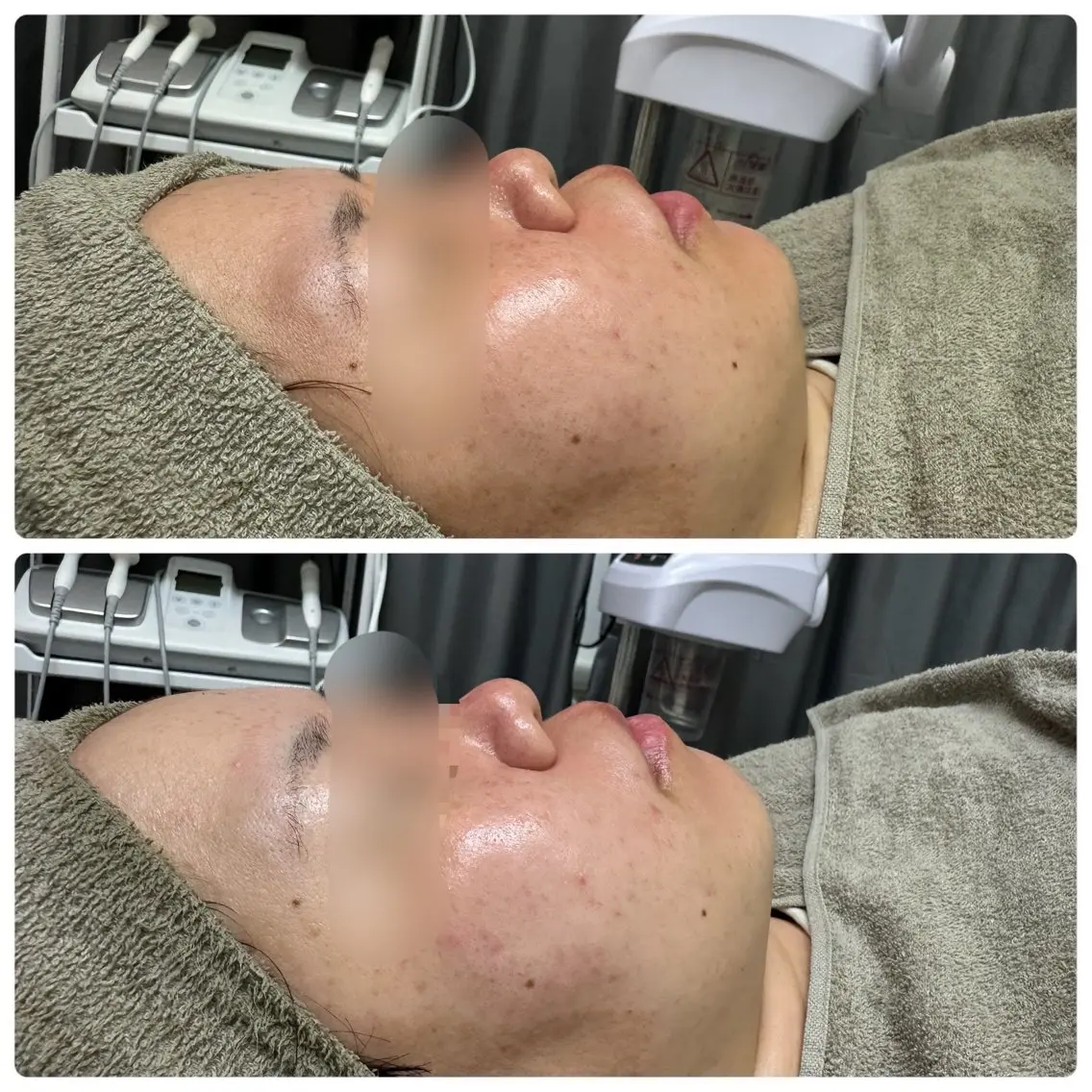 エステ beauty salonmoaのエステ・リラクイメージ