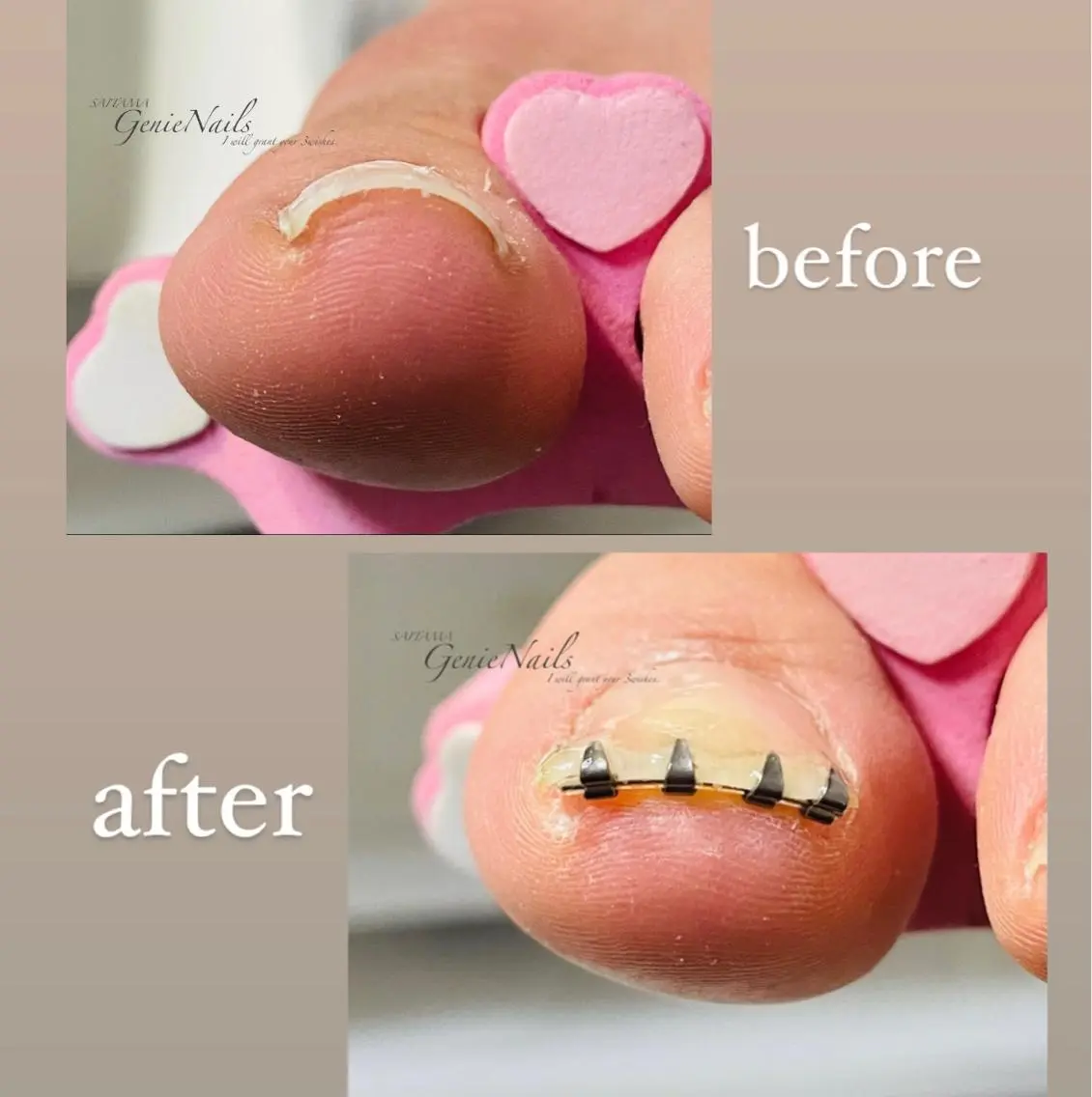メンズ ネイル フットネイル メンズネイル オフィスネイル ショートネイル 冬ネイル Genie Nailsのネイルデザイン