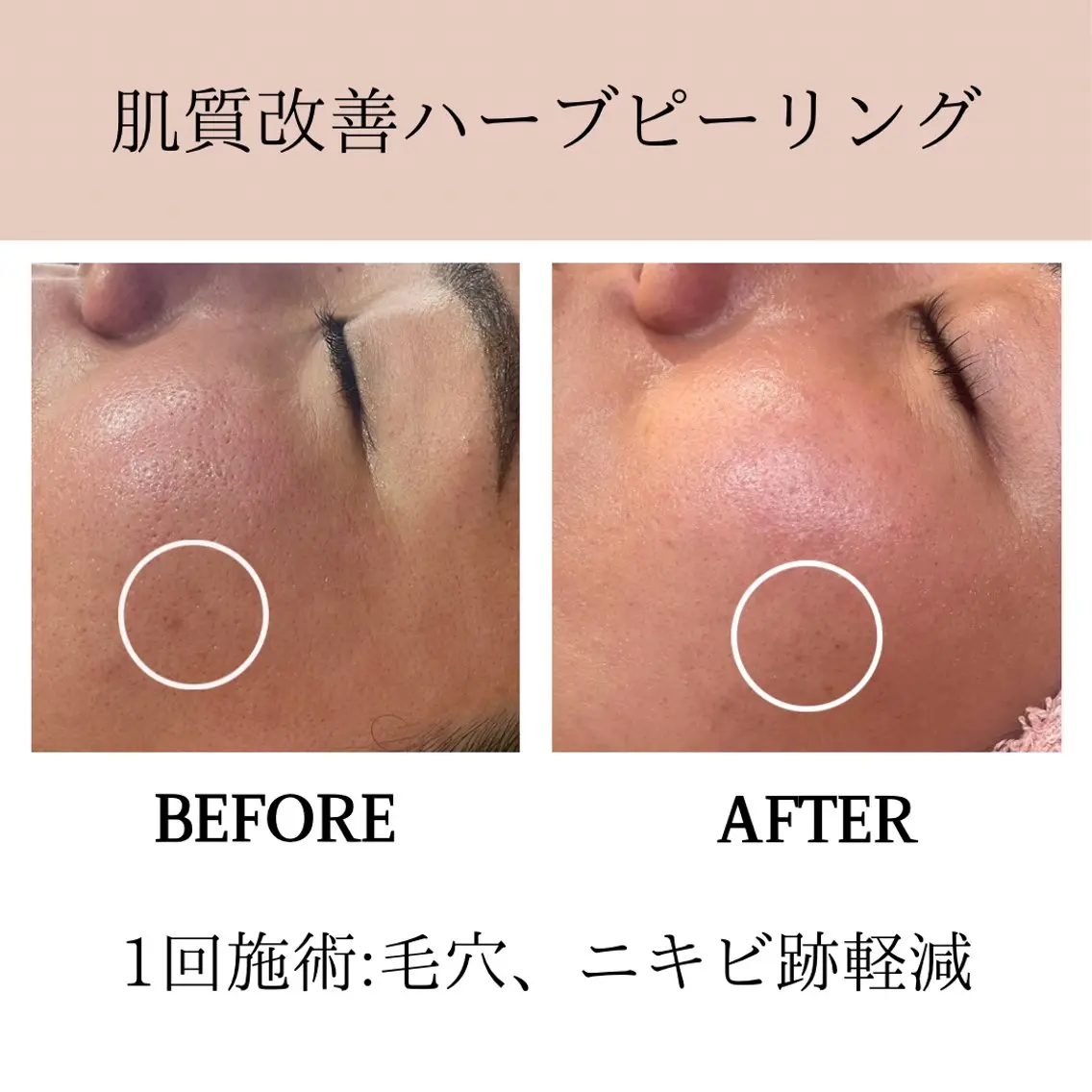 エステ 肌質改善専門サロン Bellmi/心斎橋のエステ・リラクイメージ
