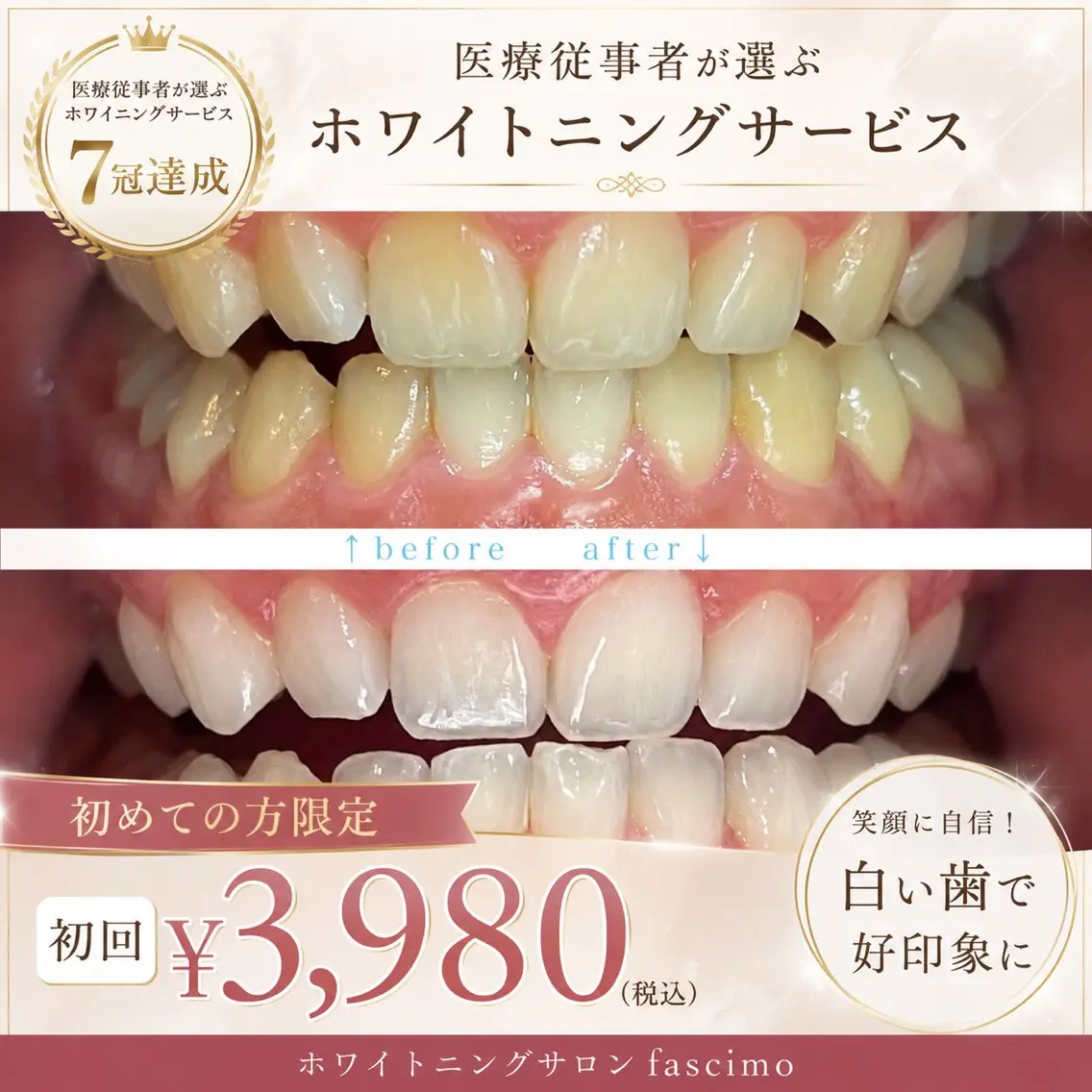 ホワイトニングサービス7冠達成のサービス👑を初回¥3,980で体験！第一印象を意識したい方、初めての方にもおすすめ✨の写真