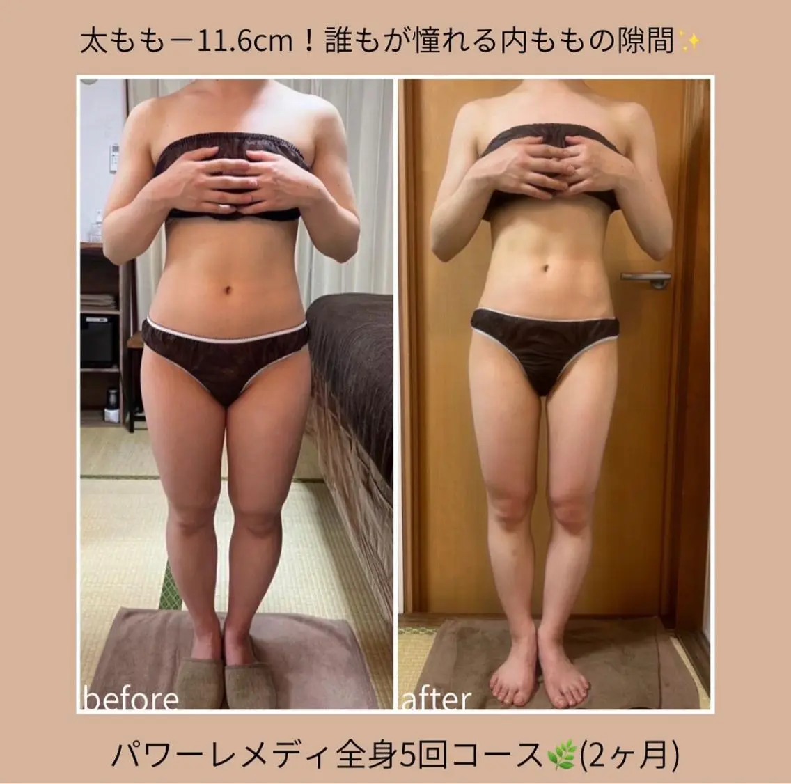 《本気痩せ×疲労改善 》 BILOOPのエステ・リラクイメージ