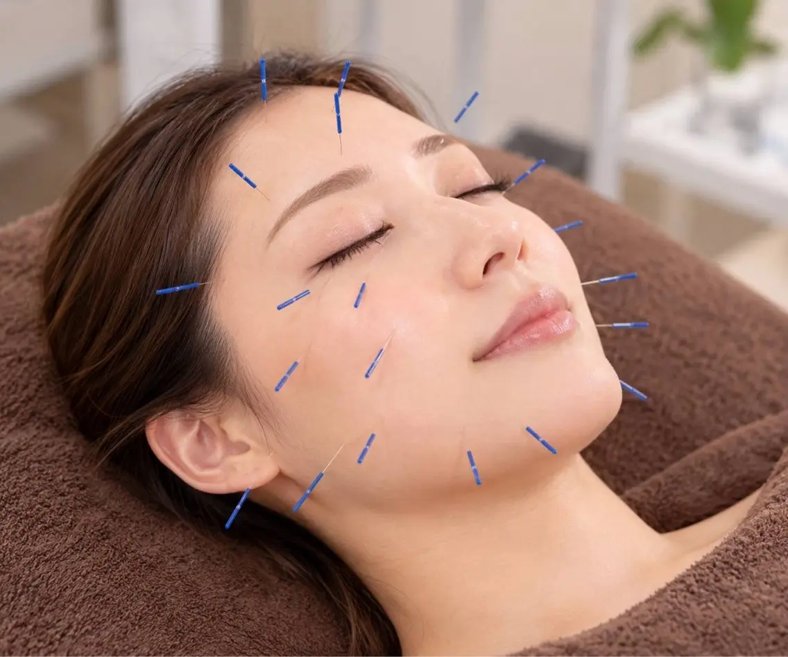耳ツボ✖️美容鍼でおしゃれと綺麗を目指しましょう✨🧚🏼‍♀️の写真
