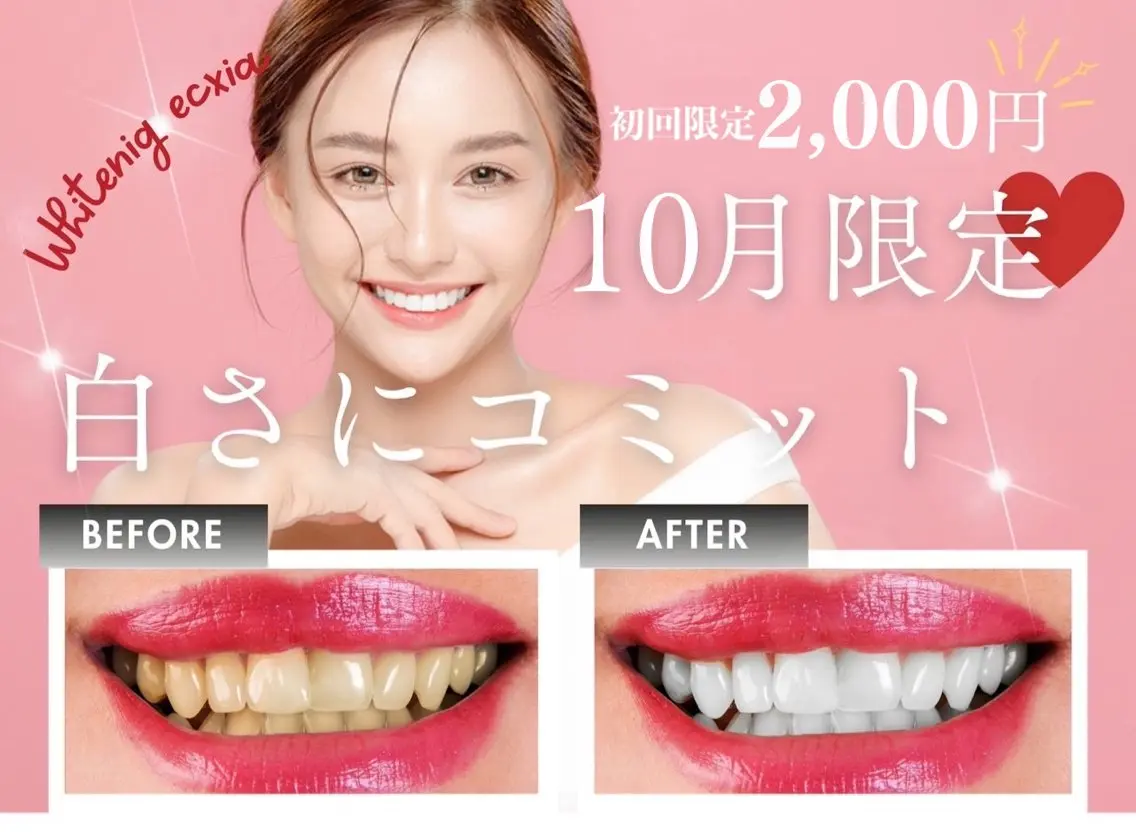 【10月限定🌟エリア最安値!!】強力セルフホワイトニング30分初回体験 ¥7980→¥2000の写真