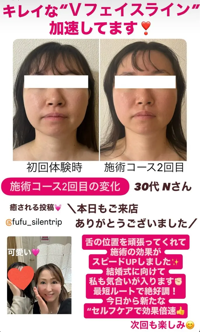 小顔サロン (ラ リュミエール)のエステ・リラクイメージ