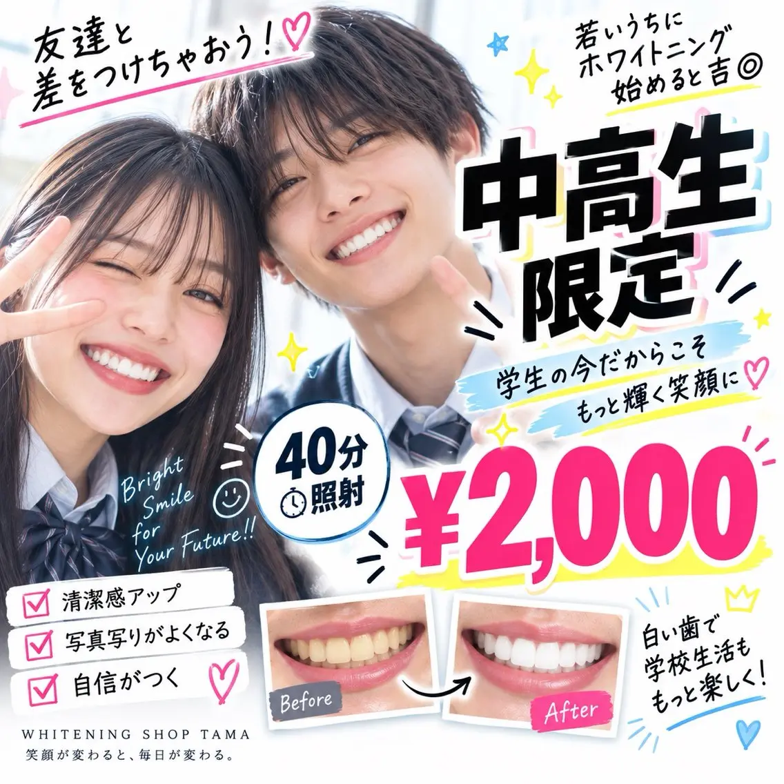 🎓中高生限定✨学生の今こそ白い歯に🦷40分セルフホワイトニング¥2,000💕の写真