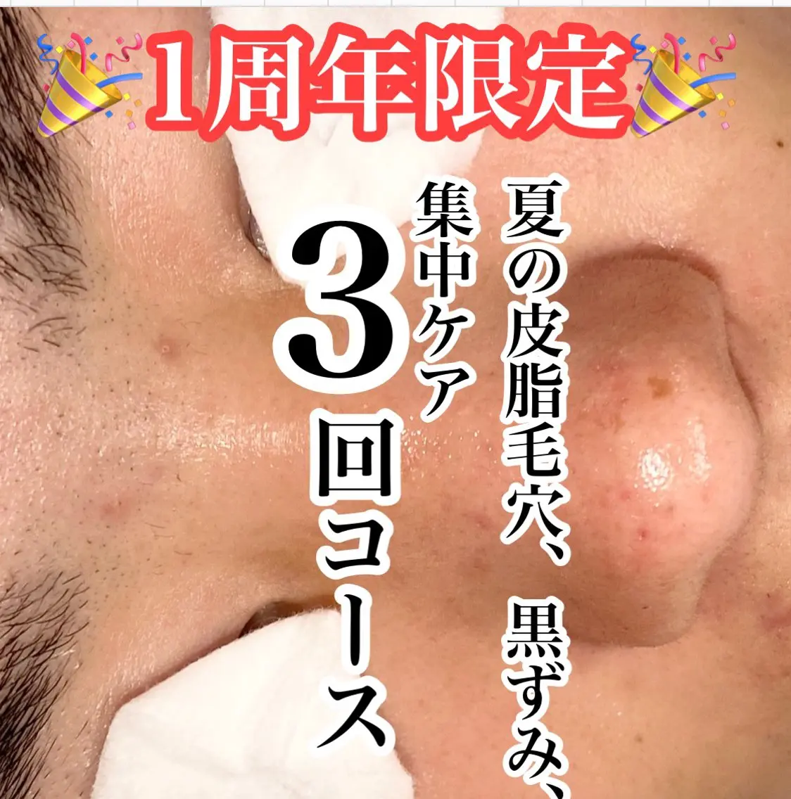 【8月5名様限定】夏の皮脂毛穴黒ずみ集中ケア3回コース【毛穴ケア、毛穴エクストラクション、肌質改善、毛穴】の写真